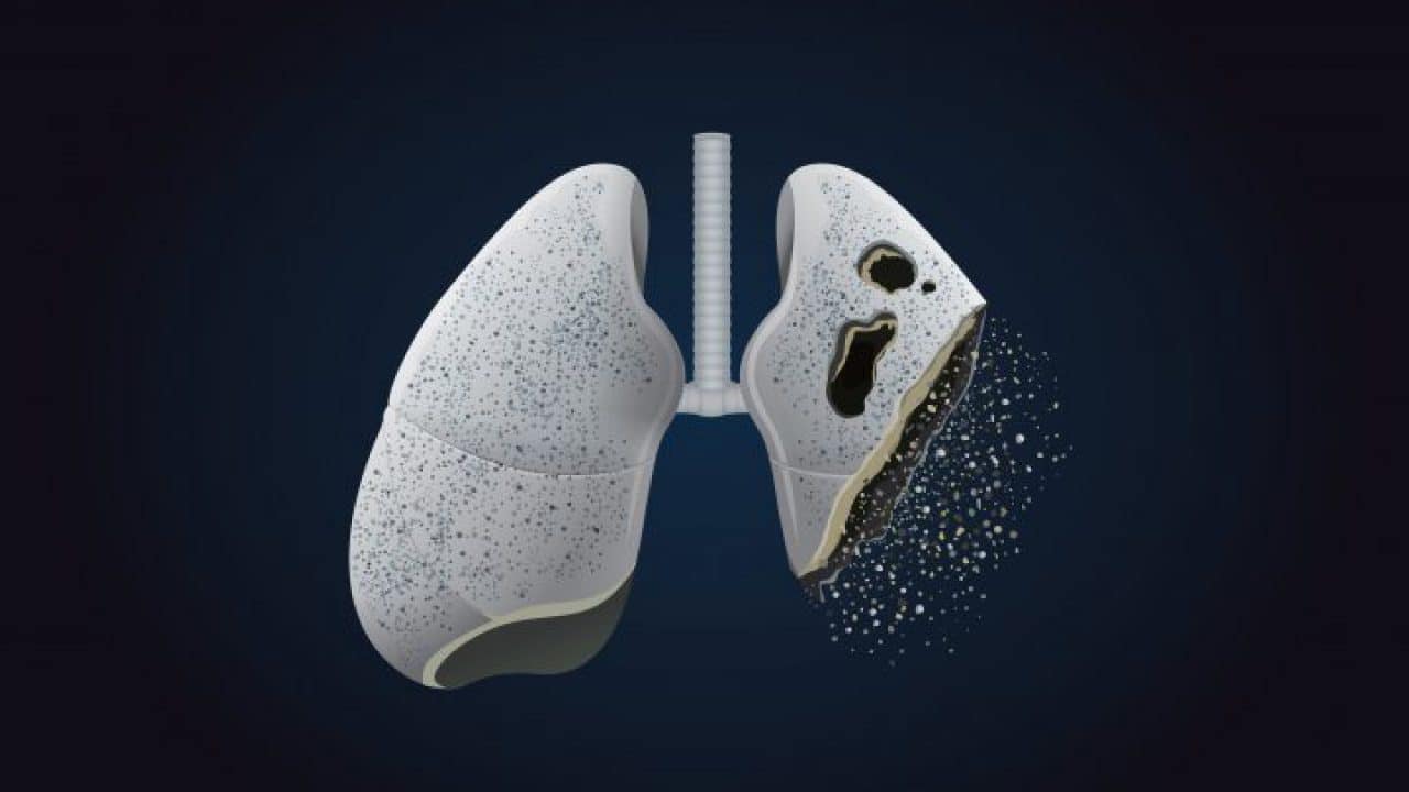 Karasevda Sigara ve Akciğer Kanseri  kapak fotoğrafı